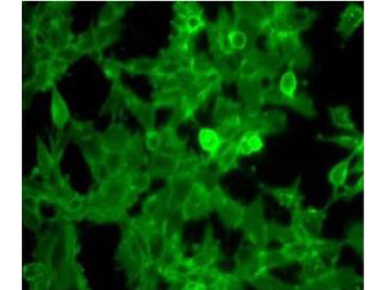B2M Antibody (HRP)