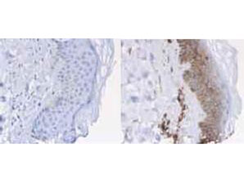 B2M Antibody (HRP)