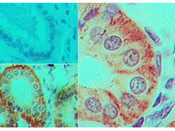 IL17F Antibody