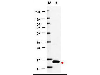 GM-CSF Antibody