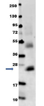 IL-6 Antibody