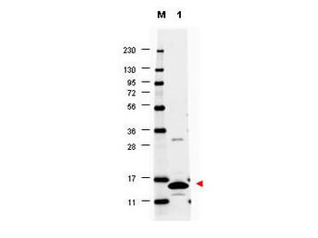 GM-CSF Antibody