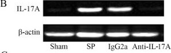 IL-17A Antibody