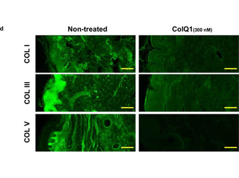 Collagen Type I Antibody