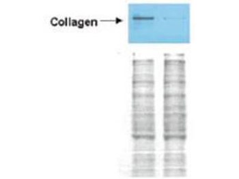 Collagen Type I Antibody