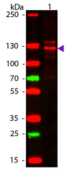 Collagen Type I Antibody