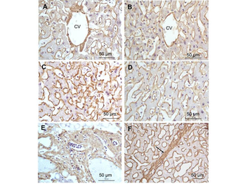 Collagen Type I Antibody