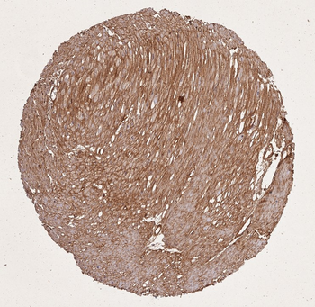 Collagen Type I Antibody