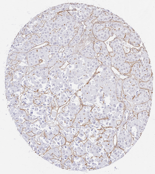 Collagen Type IV Antibody