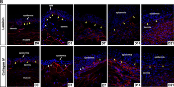 Collagen Type IV Antibody