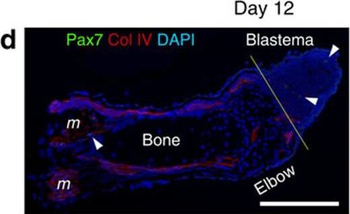 Collagen Type IV Antibody