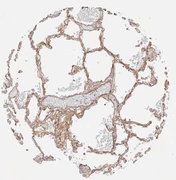 Collagen Type IV Antibody