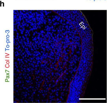 Collagen Type IV Antibody