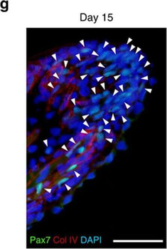 Collagen Type IV Antibody