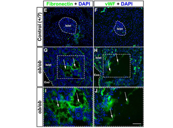 FN1 Antibody