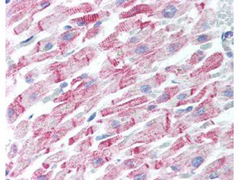 Beta Amyloid Antibody