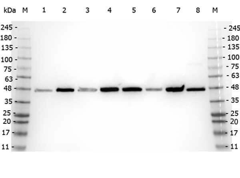 Beta Amyloid Antibody