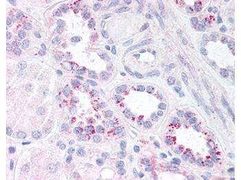 NFkB p65 phospho S536 Antibody