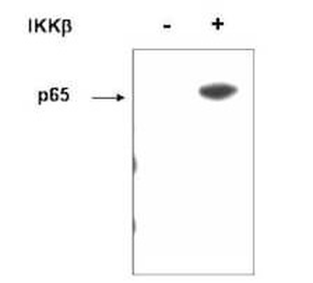 NFkB p65 phospho S536 Antibody