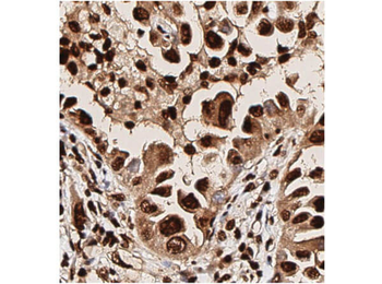 AKT phospho T308 Antibody