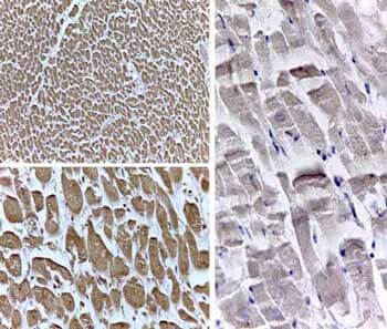 Ppard Antibody