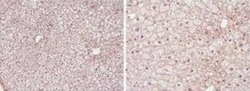 PPAR alpha Antibody