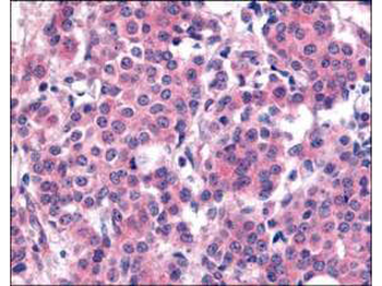 PLK1 phospho T210 Antibody