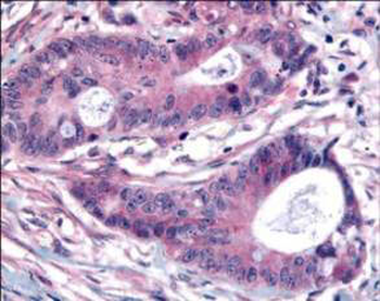 PLK1 phospho T210 Antibody