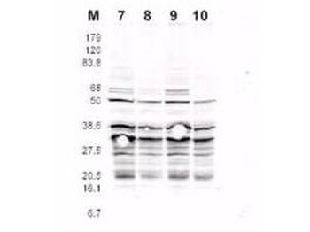 RFA2 Antibody