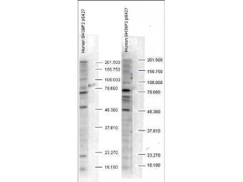 SH3BP2 Antibody