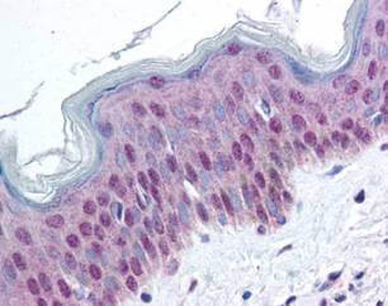 HMGN1 Antibody