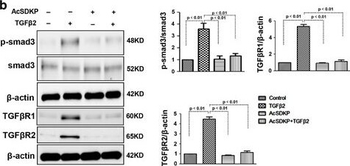 SMAD3 phospho S423/phospho S425 Antibody