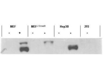 SMAD3 phospho S423/phospho S425 Antibody