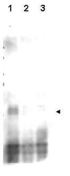 MER2, REC107 Antibody