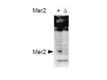 MER2, REC107 Antibody