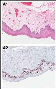 Pdcd4 phospho S457 Antibody