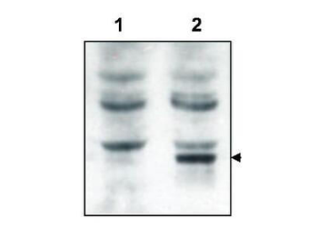 Grasp Antibody