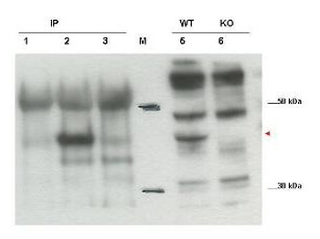 Cytip Antibody