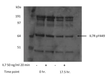 IL17R Antibody
