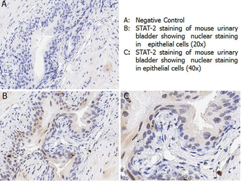 STAT2 Antibody