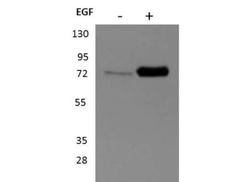 RPS6KA1 Antibody