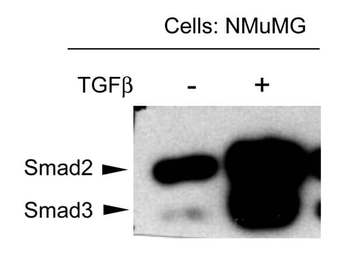SMAD3 phospho T179 Antibody