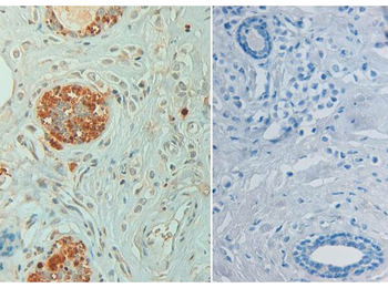 STAT6 phospho Y641 Antibody