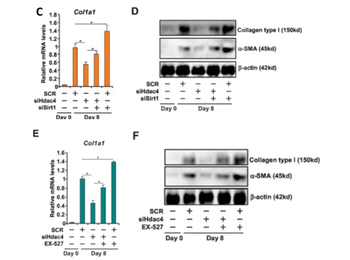 Collagen Type I Antibody Peroxidase Conjugated