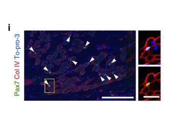 Collagen Type IV Antibody Biotin Conjugated