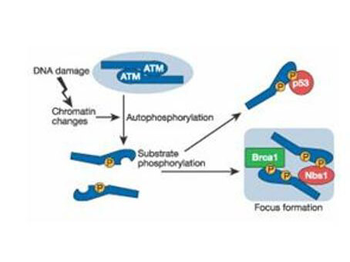 ATM Antibody