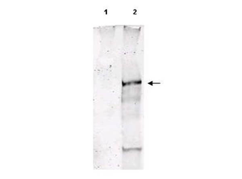 ATM Antibody