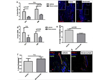 Human IgG (H&L) Antibody Texas Red Conjugated Pre-Adsorbed