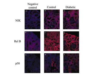 Rabbit IgG (H&L) Antibody Texas Red Conjugated Pre-Adsorbed