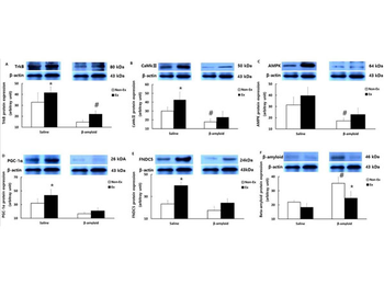 Ripa Lysis Buffer